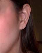 Aretes Topo Lumen