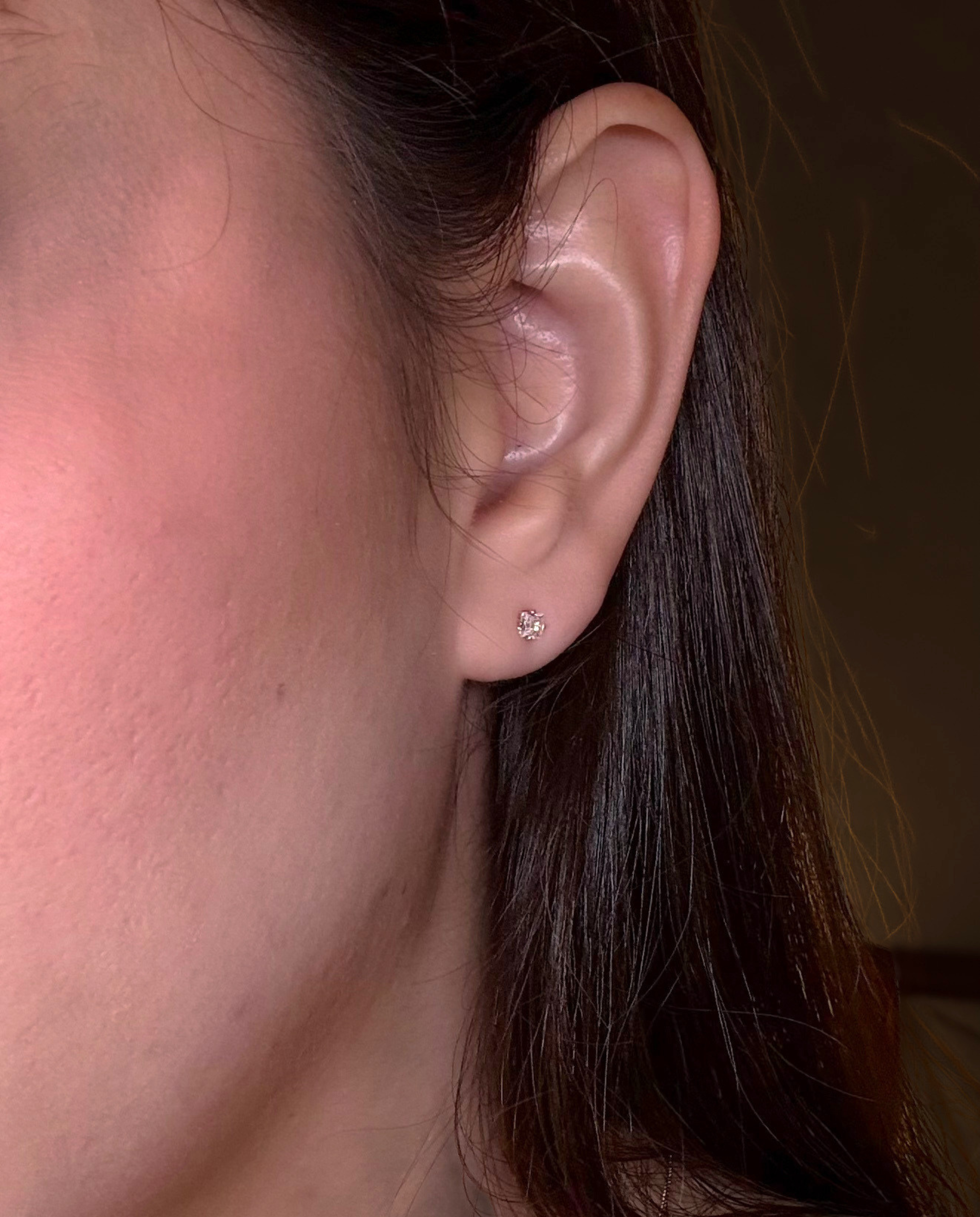 Aretes Topo Lumen